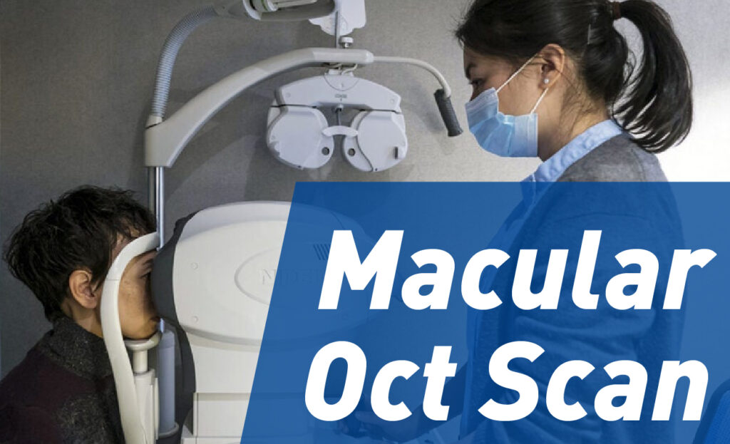 Macular OCT Scan