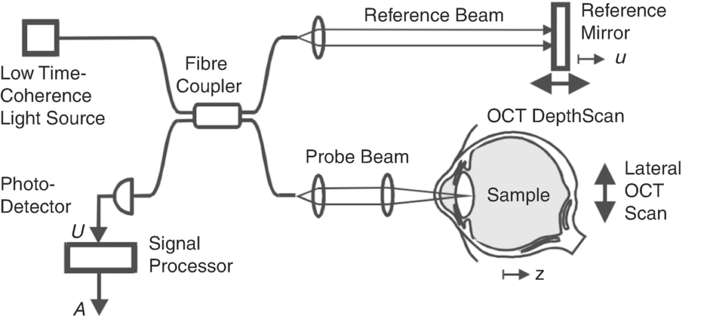 how oct eye scan works